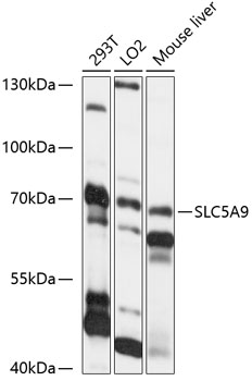 Anti-SLC5A9 Antibody (CAB14976)