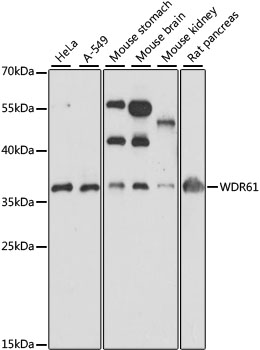 Anti-WDR61 Antibody (CAB15520)
