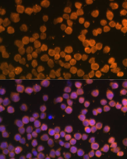 Anti-TNFRSF10A Antibody (CAB12540)