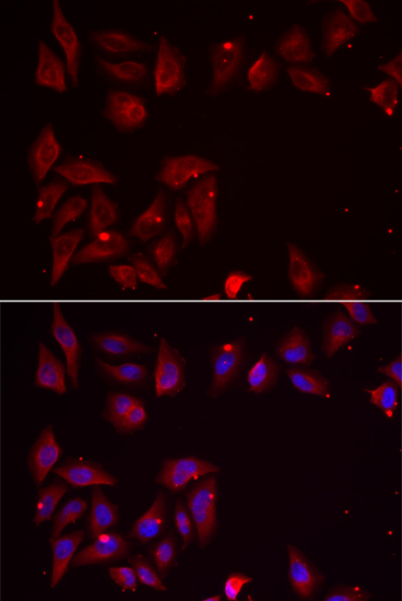 Anti-PDXK Antibody (CAB6687)