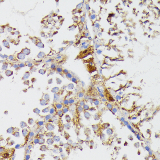 Anti-GALC Antibody (CAB3873)