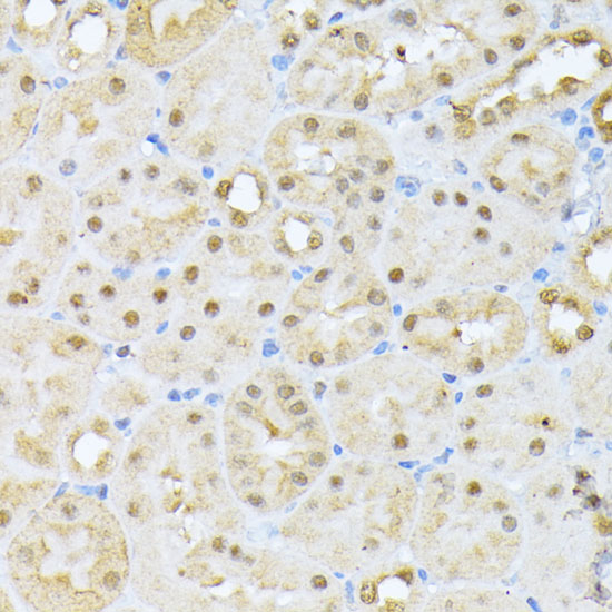 Anti-CKII Alpha Antibody (CAB1014)