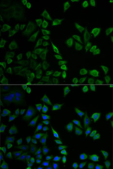 Anti-MSLN Antibody (CAB14099)