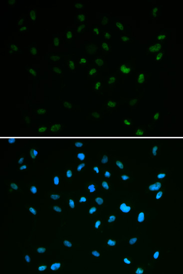 Anti-MSH6 Antibody (CAB3177)