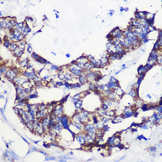 Anti-ACSS1 Antibody (CAB15007)