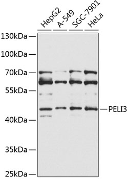 Anti-PELI3 Polyclonal Antibody (CAB9999)