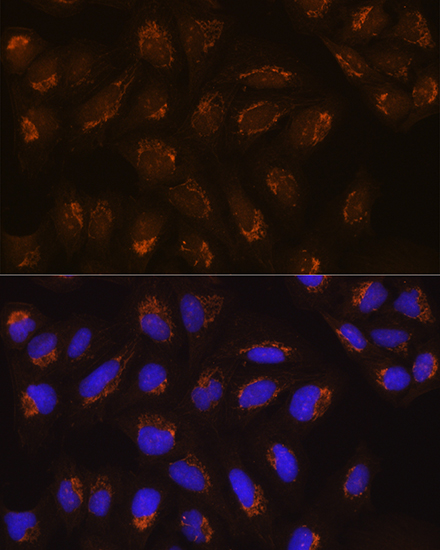 Anti-POFUT2 Antibody (CAB12223)