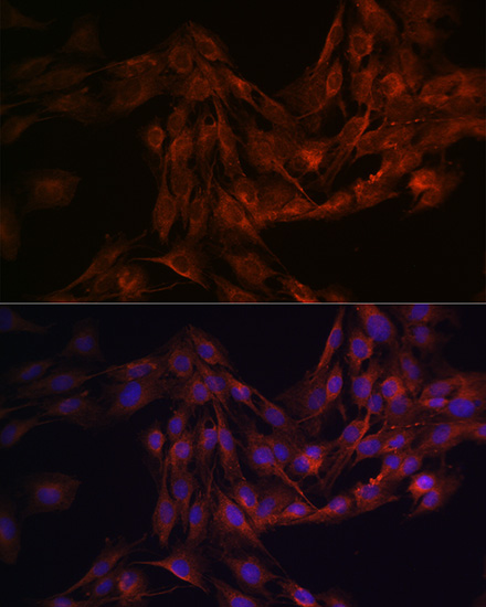 Anti-GRIN1 Antibody (CAB7677)