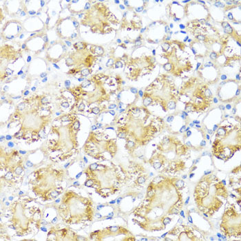 Anti-MAS1 Polyclonal Antibody (CAB8132)