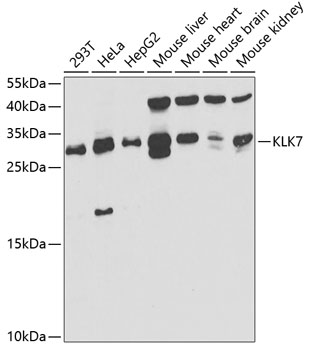 Anti-KLK7 Antibody (CAB5506)