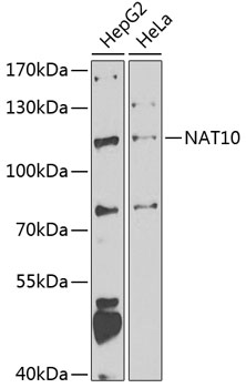 Anti-NAT10 Antibody (CAB7292)