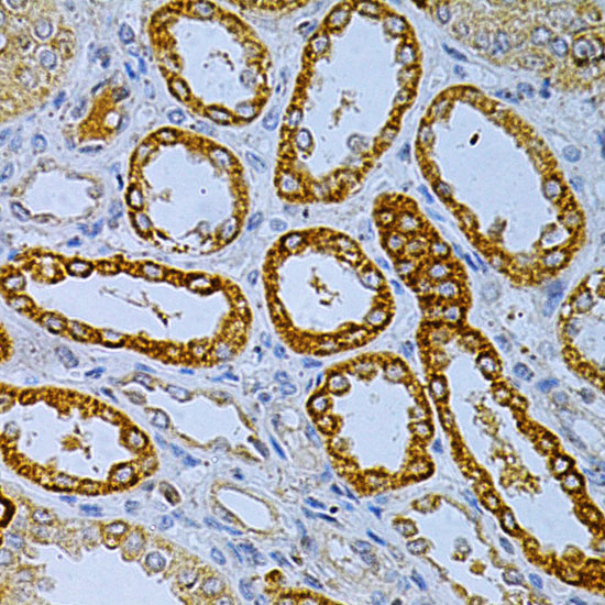 Anti-OLR1 Antibody (CAB1639)