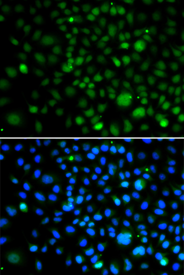 Anti-KLF15 Antibody (CAB13420)