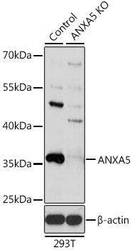 Anti-ANXA5 Antibody [KO Validated] (CAB1728)