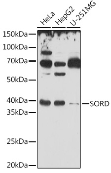 Anti-SORD Antibody (CAB2118)