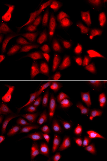 Anti-RUVBL2 Antibody (CAB1905)