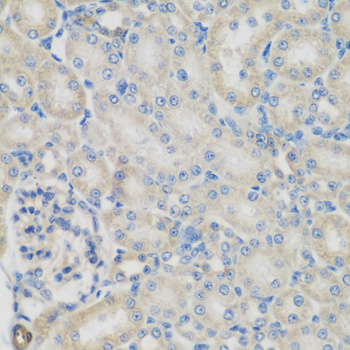 Anti-GPI Antibody (CAB13308)