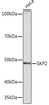 Anti-SKP2 Antibody (CAB4046)