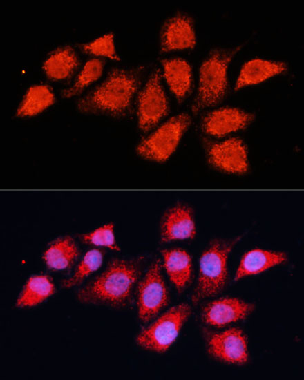 Anti-PDHA2 Polyclonal Antibody (CAB9943)