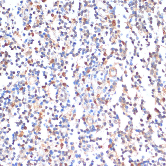 Anti-ZMYM3 Antibody (CAB12990)