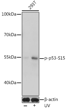 Anti-Phospho-p53-S15 Antibody (CABP0950)