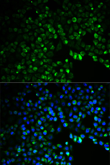 Anti-UGDH Antibody (CAB1210)