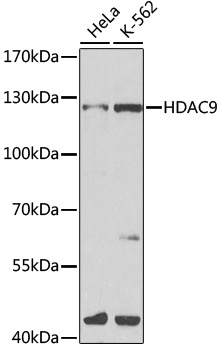 Anti-HDAC9 Antibody (CAB1516)