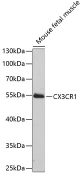 Anti-CX3CR1 Antibody (CAB2890)