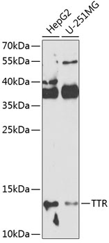 Anti-TTR Antibody (CAB1120)