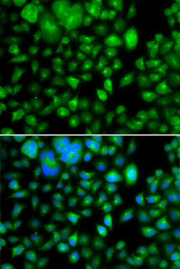 Anti-METTL7B Antibody (CAB7200)