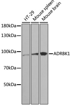 Anti-ADRBK1 Antibody [KO Validated] (CAB1662)