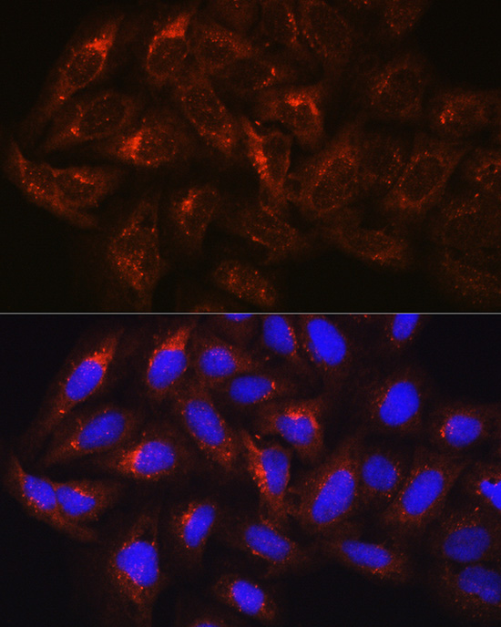 Anti-HGS Antibody (CAB1790)