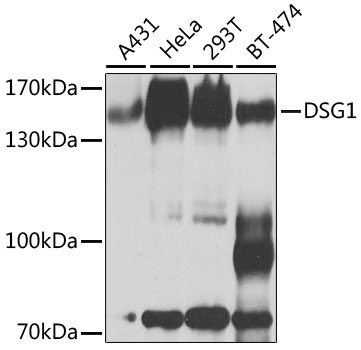 Anti-Desmoglein-1 Polyclonal Antibody (CAB9812)