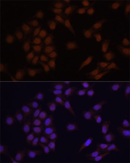 Anti-PRDM14 Antibody (CAB6502)