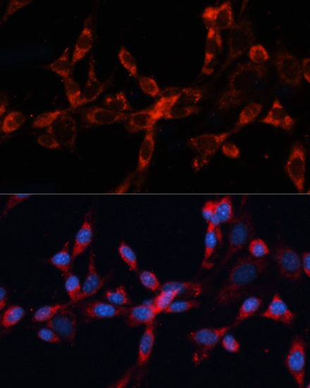 Anti-CTSL Antibody (CAB12066)