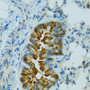 Anti-CYP2B6 Antibody (CAB1463)