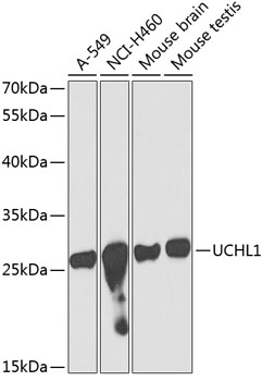 Anti-UCHL1 Antibody (CAB2131)