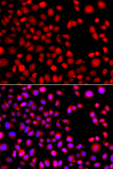 Anti-HLX Antibody (CAB13313)