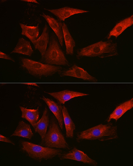 Anti-TYMS Antibody (CAB10441)