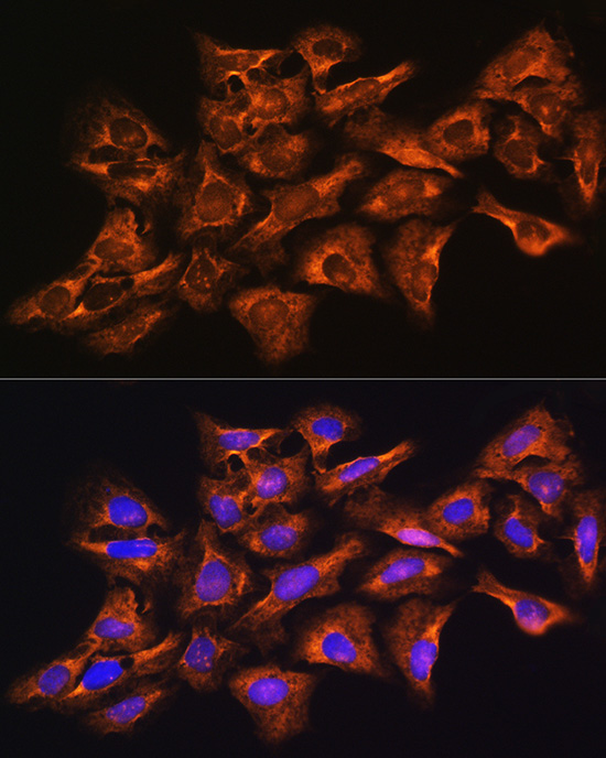 Anti-GNB1 Antibody (CAB1867)