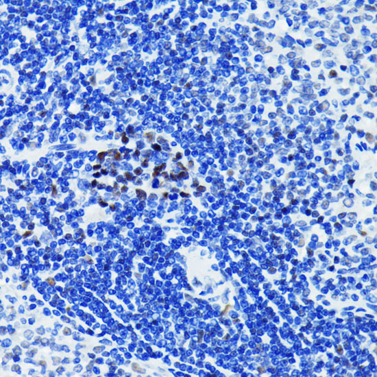 Anti-PARP Antibody [KO Validated] (CAB19596)