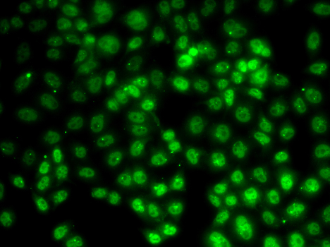 Anti-PRMT2 Antibody [KO Validated] (CAB5835)