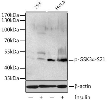 Anti-Phospho-GSK3A-S21 Antibody (CABP0582)