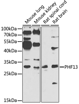 Anti-PHF13 Antibody (CAB7854)