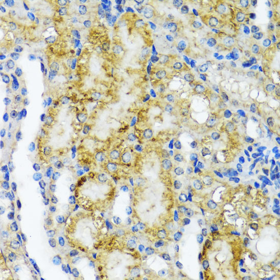 Anti-NMT1 Antibody (CAB16408)