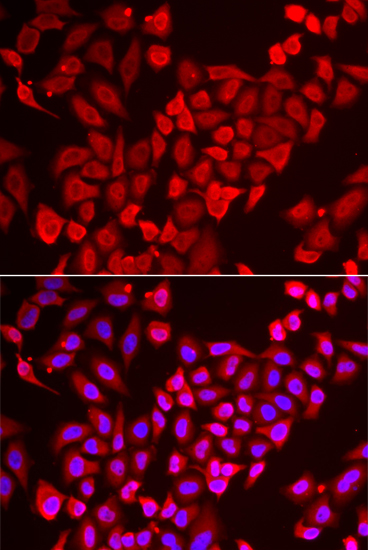 Anti-TNP2 Antibody (CAB6773)