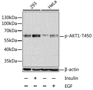 Anti-Phospho-AKT1-T450 Antibody (CABP0004)