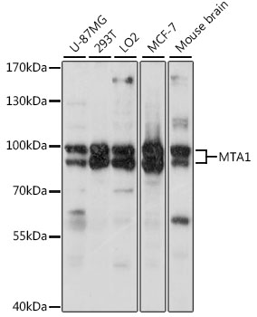 Anti-MTA1 Antibody (CAB16085)
