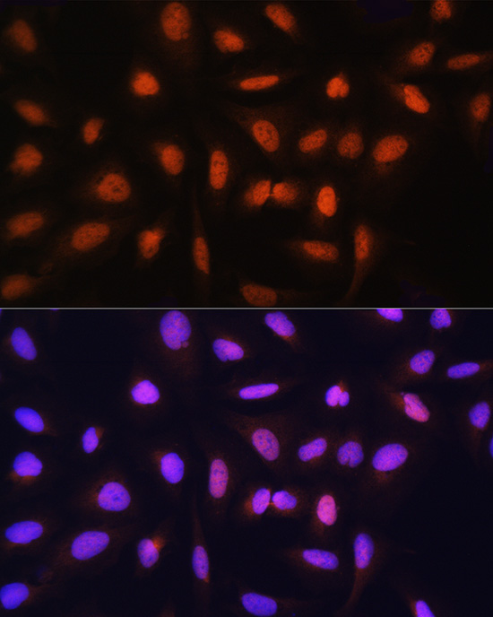 Anti-GTF2H1 Antibody (CAB6814)