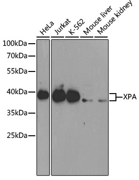 Anti-XPA Antibody [KO Validated] (CAB1626)